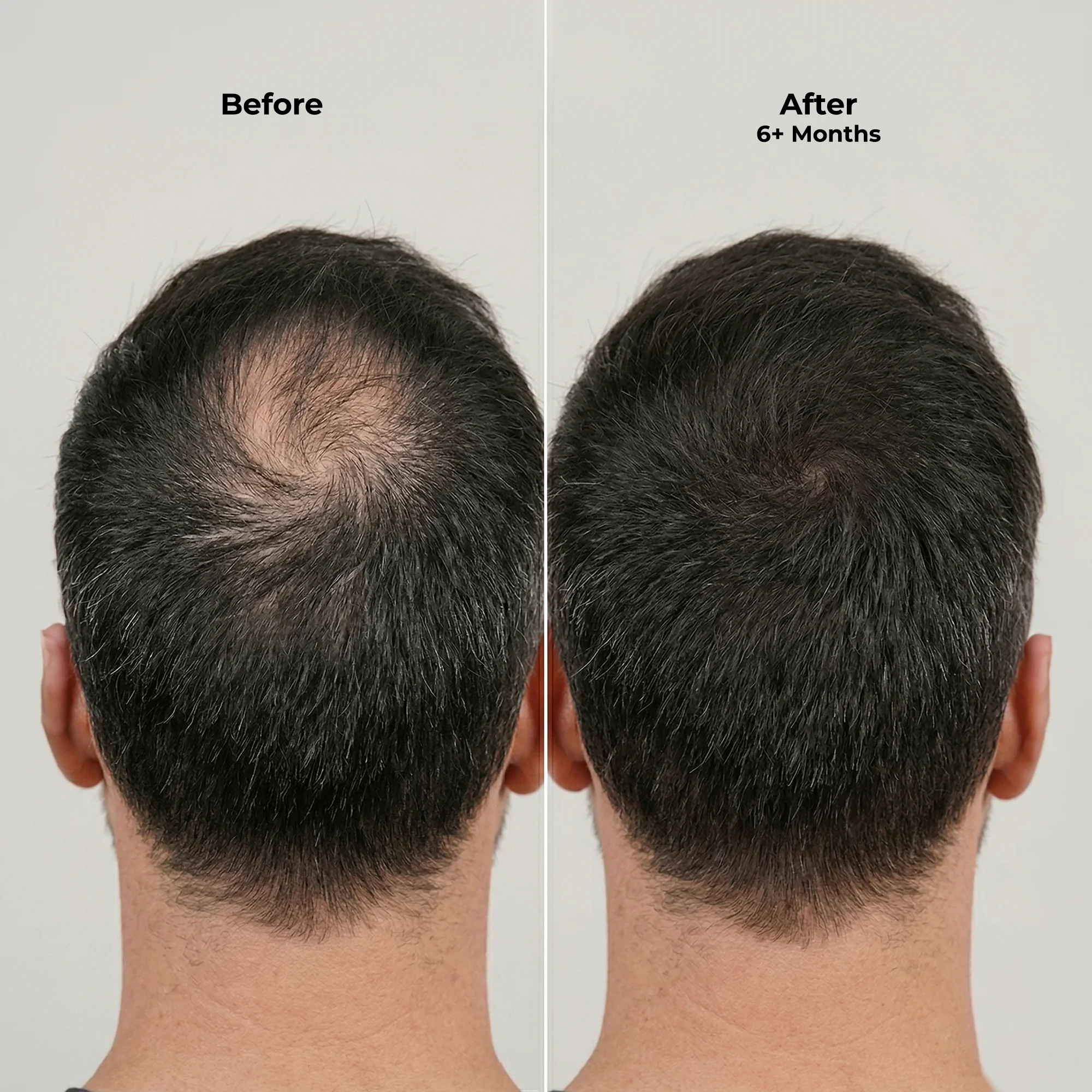 Ghori Derma Roller — view 5